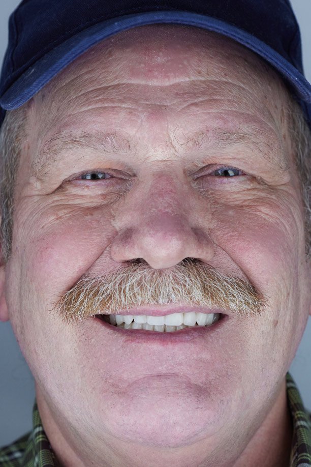 Functional Dentistry Patient Eric after Photo