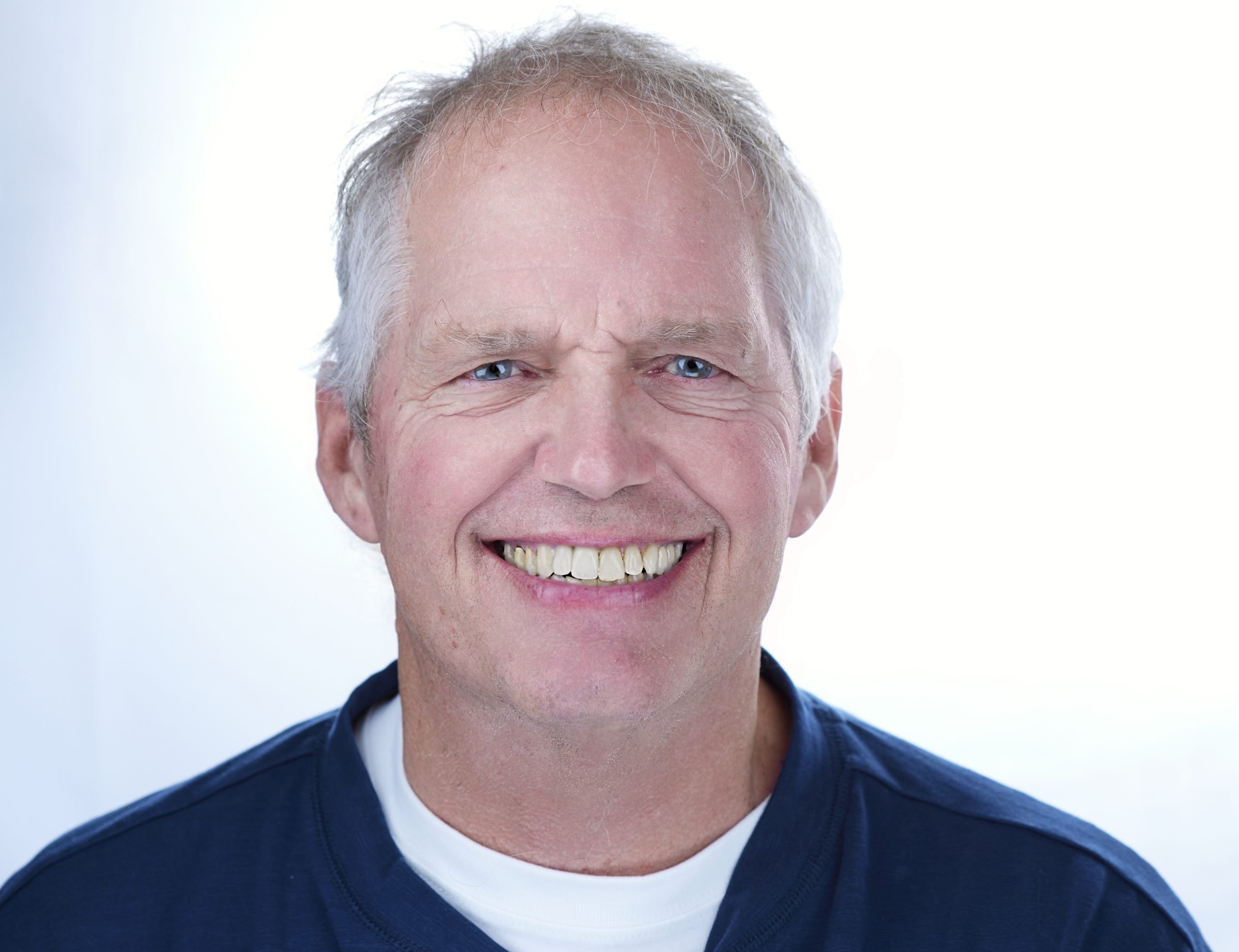 Restorative Dentistry Patient Tom Berg After Photo