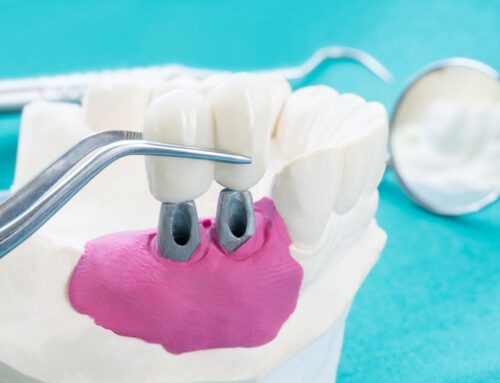 Are Dental Implants Worth It? A Quad Cities Patient Guide  